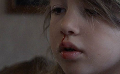 Ϊʲô������Ѫ ����Ѫ��ԭ��